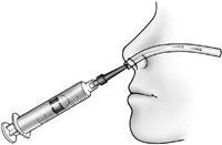 3cc Luer-Lok syringe